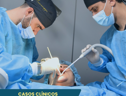 Colocación de implantes con Regeneración – Periodoncia