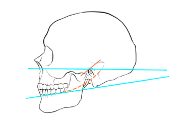 Máster en Prótesis, Implantoprótesis y Estética