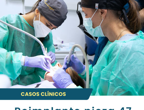 Dra. Irma Juárez y Residente – Reimplante de la pieza 47